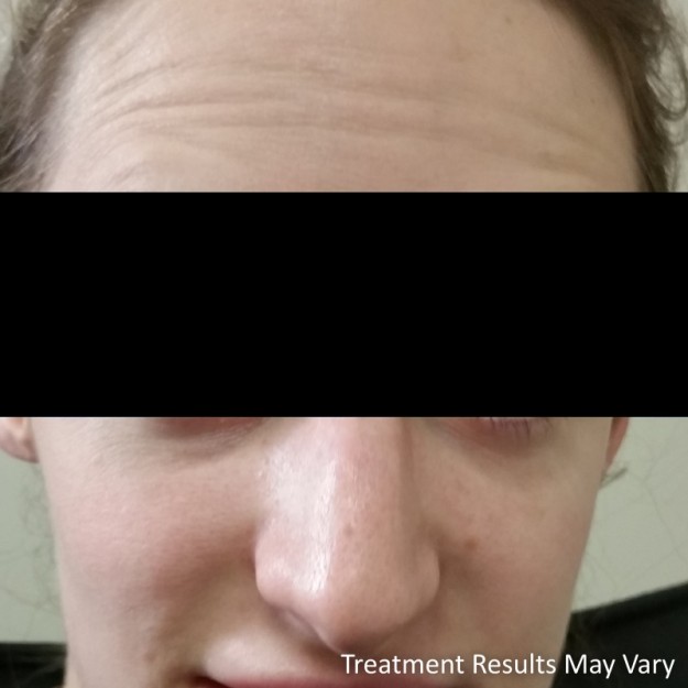 beautify-sa-bella-maintains-her-flawless-skin-relaxers-and-fillers-4