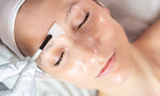 chemical-skin-peel-pigmentation-acne-wrinkles-hydration-beautifySA